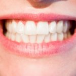 Nowoczesna technika wykorzystywana w salonach stomatologii estetycznej być może spowodować, że odzyskamy prześliczny uśmiech.